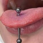 کلینیک تخصصی لاغری و لیزر مبینا