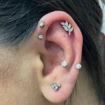 کلینیک تخصصی لاغری و لیزر مبینا