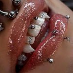 کلینیک تخصصی لاغری و لیزر مبینا